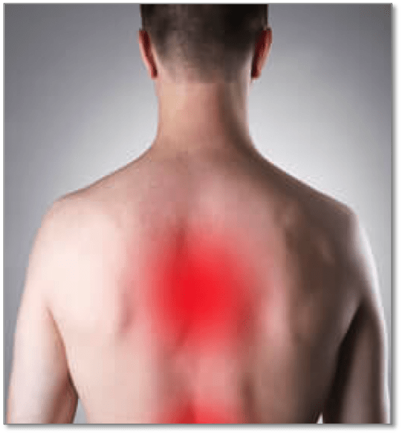 Lower And Mid-Back Pain Singapore